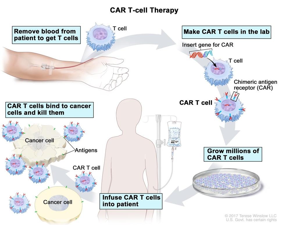 CAR T-cell Therapy Scientific Clinical Process